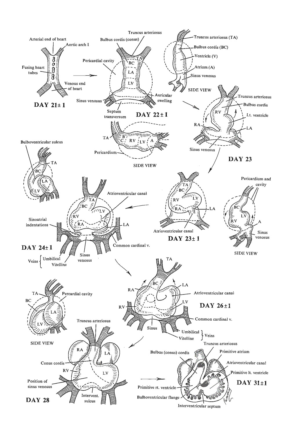 Chapter 115. Development of The Heart: Formation of The Heart Loop ...