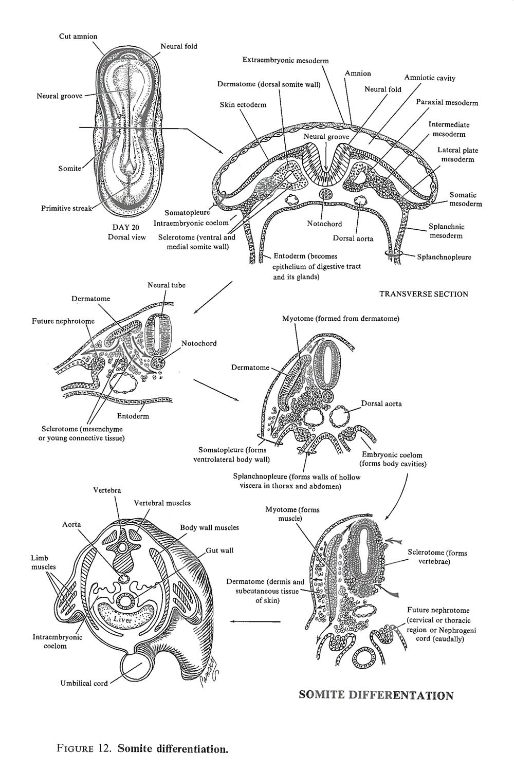 Chapter 20. Week 3 of Development: Intraembryonic Mesoderm, Somite ...